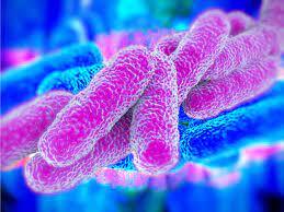 LEGIONELLA- Informacja